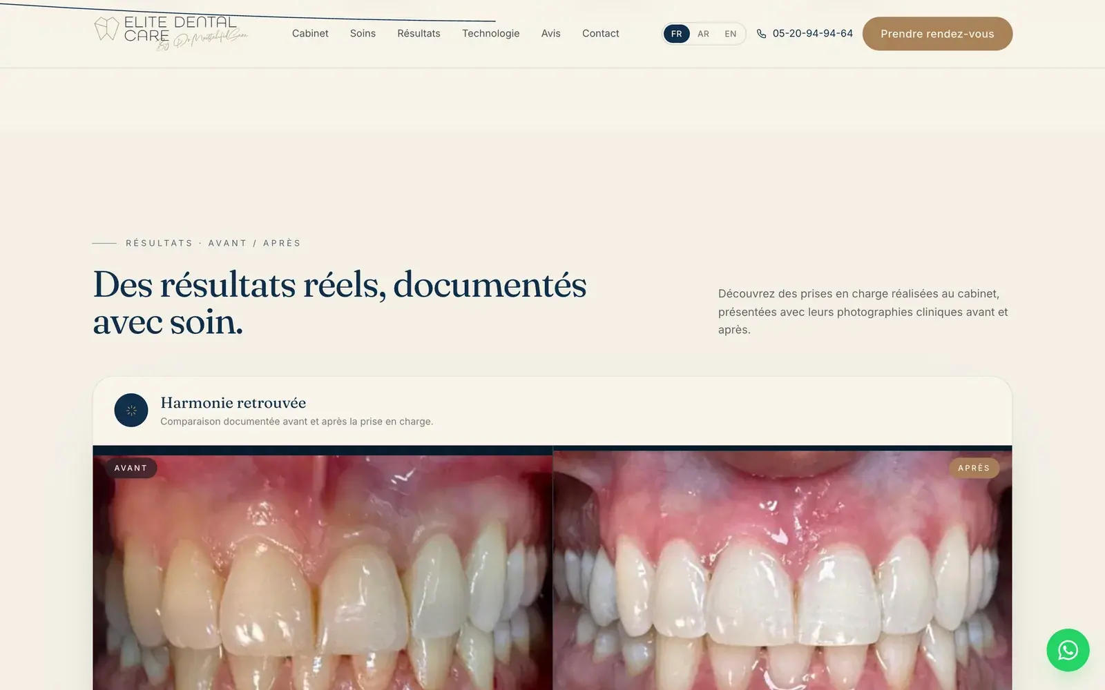 Elite Dental Care dental clinic website — Documented before-and-after results (desktop screenshot)